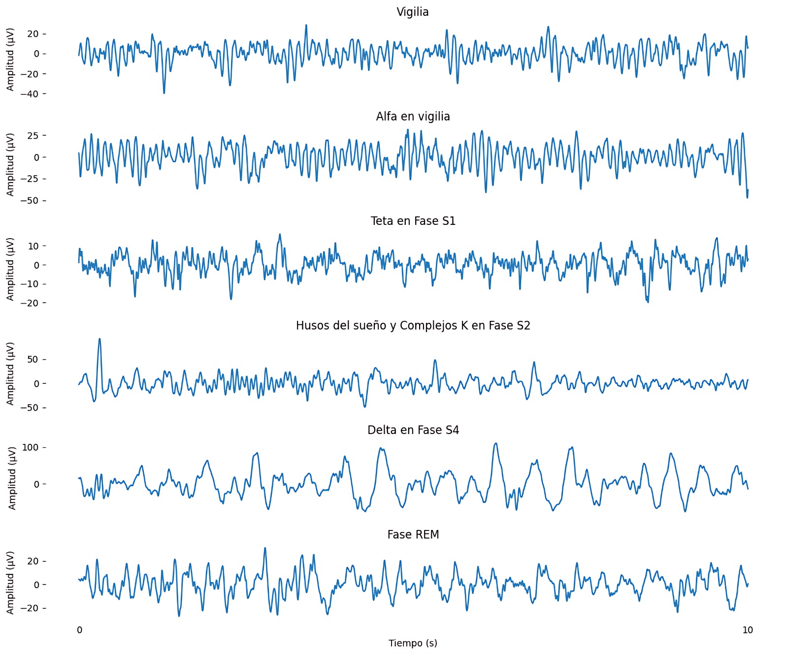 Gráfico de señales encefalográficas